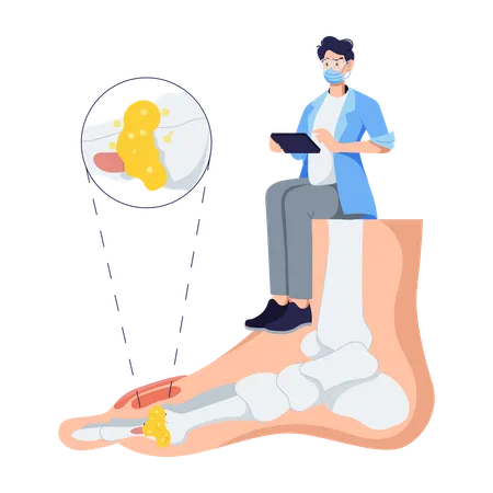 Man Suffers From Gout  Illustration
