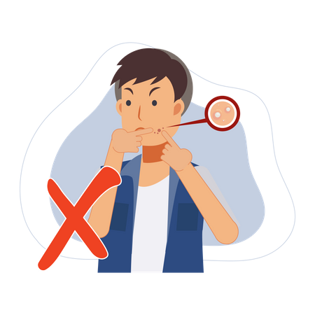 Man trying to pop pimple on the acne face Illustration