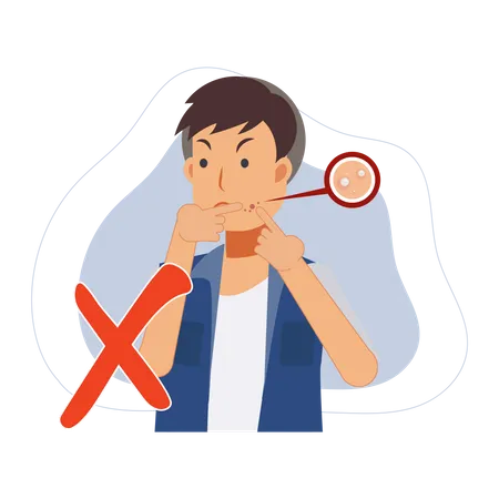Man trying to pop pimple on the acne face  Illustration