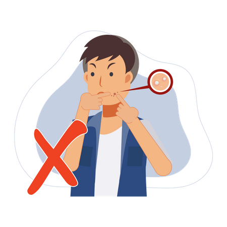 Man trying to pop pimple on the acne face  Illustration