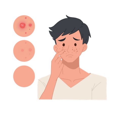 Man with pimples on his face Illustration