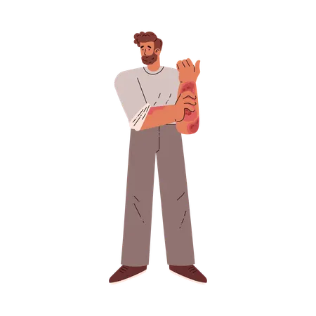皮膚病を患う男性  イラスト
