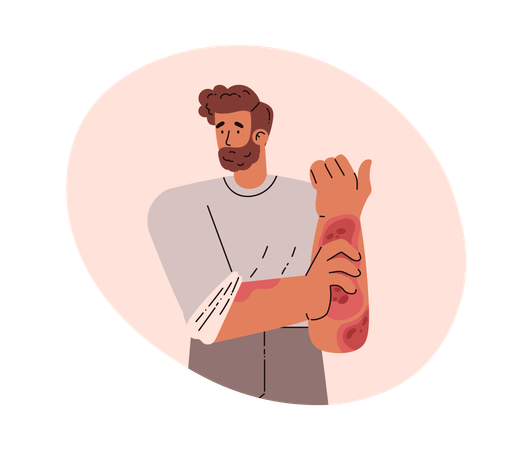 皮膚疾患のある男性  イラスト