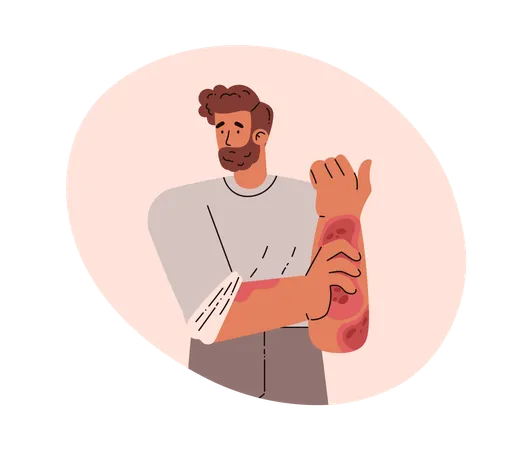 皮膚疾患のある男性  イラスト