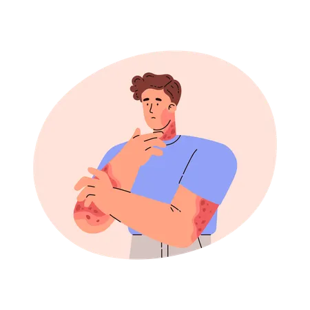 手に皮膚疾患のある男性  イラスト