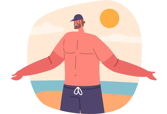 Man With Sunburned Hands Red And Peeling From Prolonged Sun Exposure A Painful Reminder Of The Importance Of Sun Protection Male Character On The Beach Cartoon People Vector Illustration Illustration