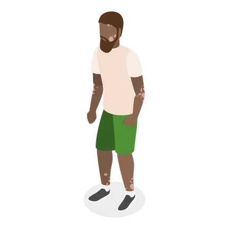 Man with Vitiligo  Illustration