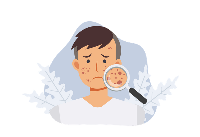 Mann mit Akne-Hautproblem  Illustration