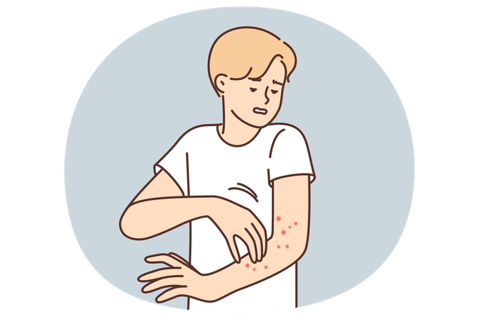 Mann mit Ausschlag am Arm leidet unter Juckreiz und Ekzemen, die durch eine Infektion verursacht werden, die die Haut befällt  Illustration