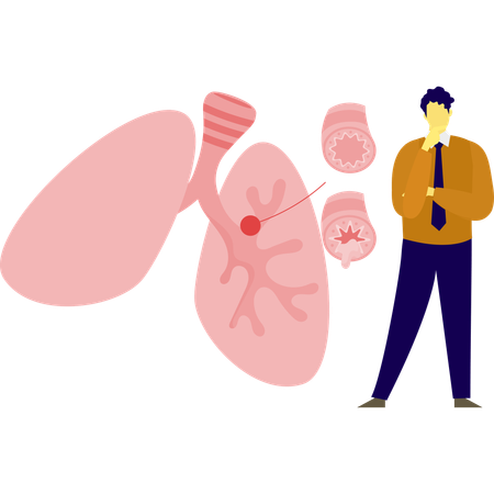 Männlicher Arzt denkt über Asthma nach  Illustration