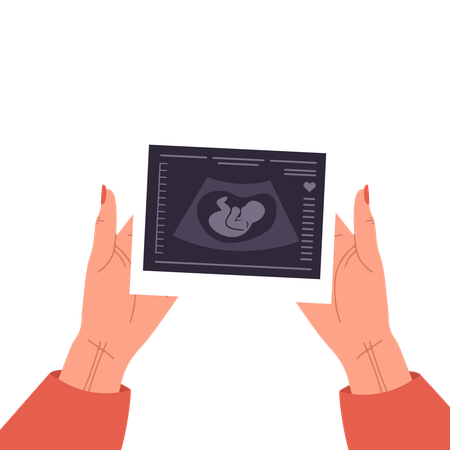 Informe de ecografía de manos femeninas sosteniendo un feto  Ilustración