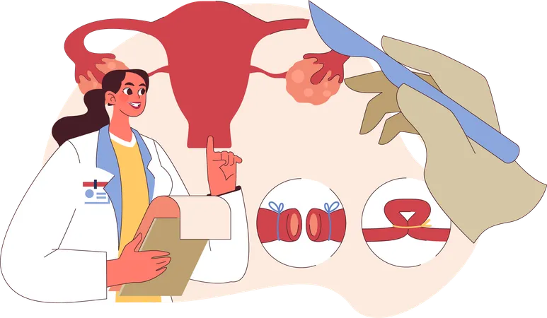Médico realiza cirugía de ovario  Ilustración