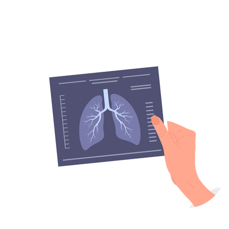 Médico segurando raio X dos pulmões  Ilustração