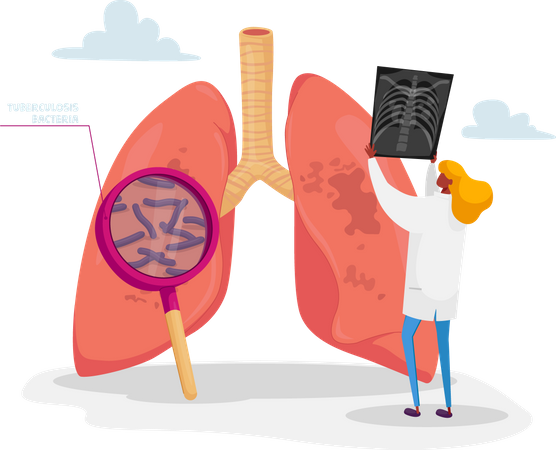 Médico sosteniendo una imagen de rayos X de los pulmones aprendiendo fluorografía del paciente con tuberculosis o neumonía  Ilustración