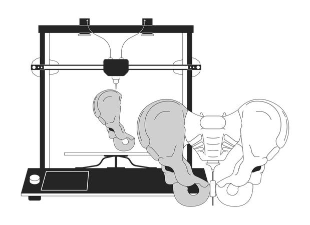 Modelo de pélvis de impressão 3D  Ilustração