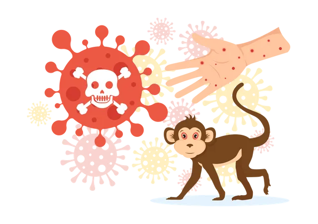Monkey Pox Outbreak Vector Illustration Of Virus Symptoms In Humans Monkeypox Microbiological In Flat Cartoon Hand Drawn Templates Illustration