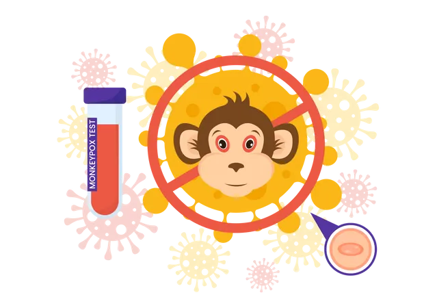 Monkeypox Outbreak  Illustration