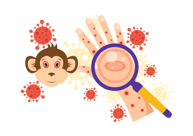 Monkeypox Outbreak  Illustration