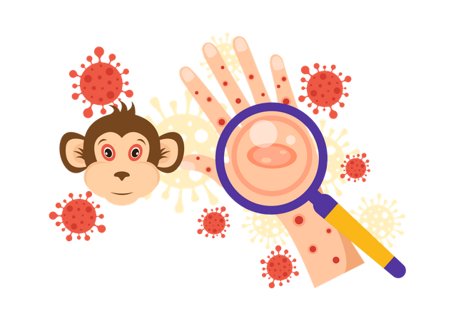 Monkeypox Outbreak  イラスト