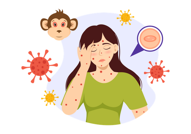Monkeypox Outbreak  イラスト