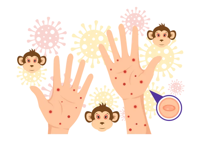 Monkeypox Virus  Illustration