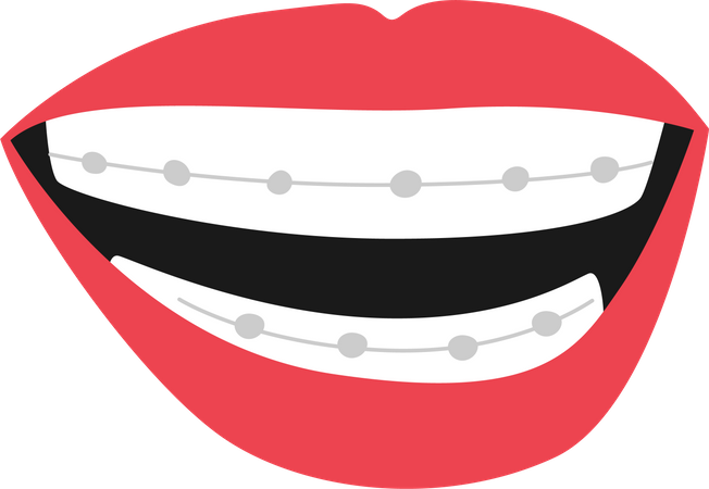 Mouth With Braces Features  Illustration