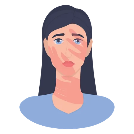 Mujer con marca de bofetada en la cara que sufre violencia doméstica  Ilustración