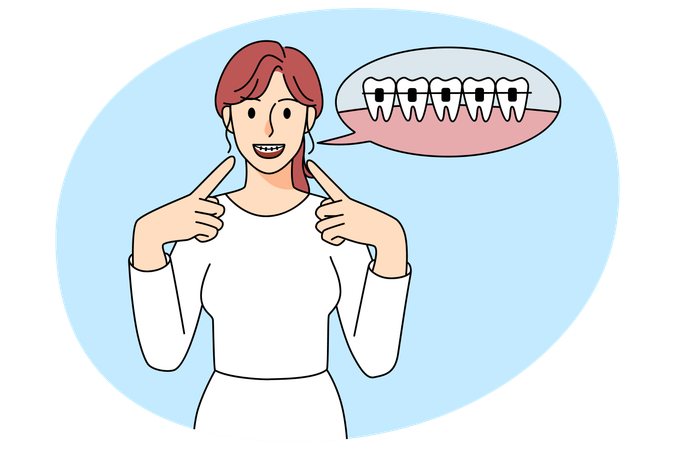 Mujer feliz señalando aparatos dentales en los dientes  Ilustración
