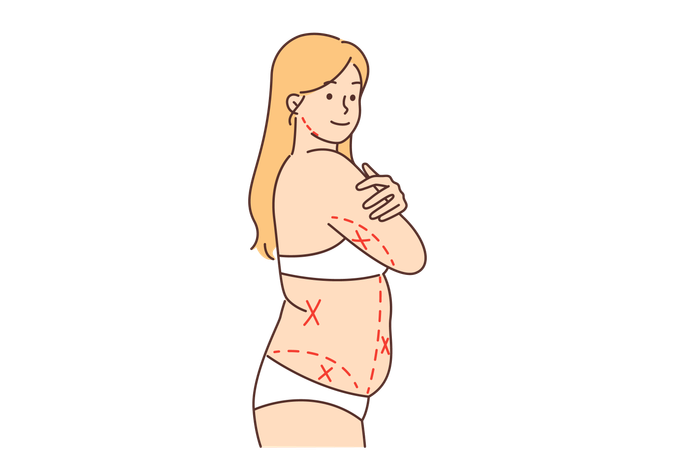 Mujer gorda sin ropa con líneas en el cuerpo.  Ilustración