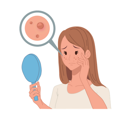 Mujer mirándose al espejo debido a un problema de acné  Ilustración