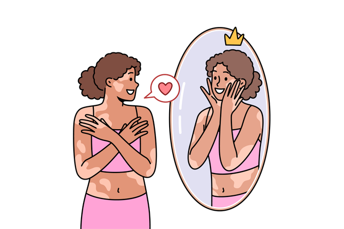 Mulher com síndrome de vitiligo olha no espelho e sorri, aceitando-se como ela é  Illustration