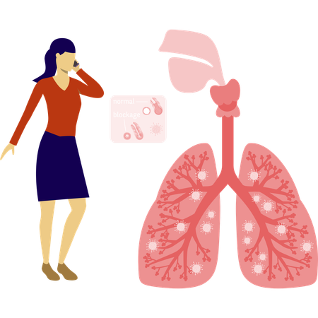 Mulher falando sobre infecção pulmonar móvel  Ilustração