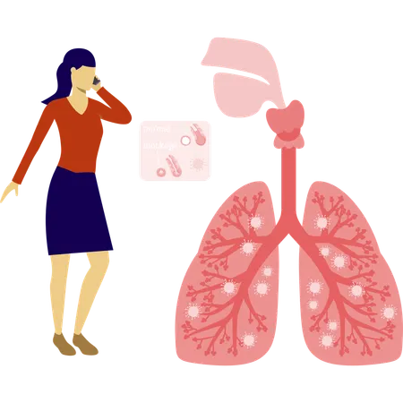 Mulher falando sobre infecção pulmonar móvel  Ilustração