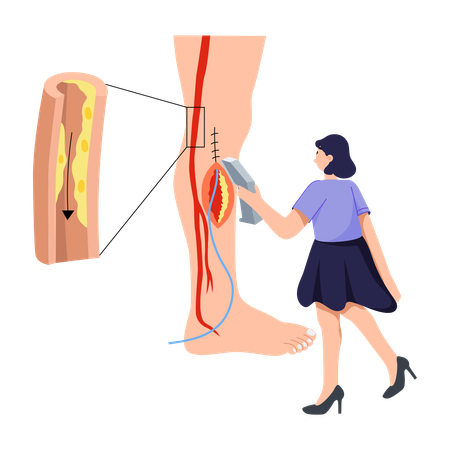 Mulher fazendo cirurgia nas pernas  Ilustração