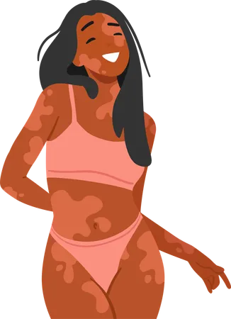 Mulher feliz com vitiligo abraça sua beleza única  Ilustração