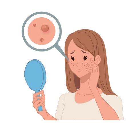 Mulher olhando no espelho devido a problema de acne  Ilustração