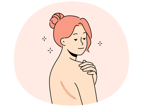 Naked woman show scar on back  Illustration