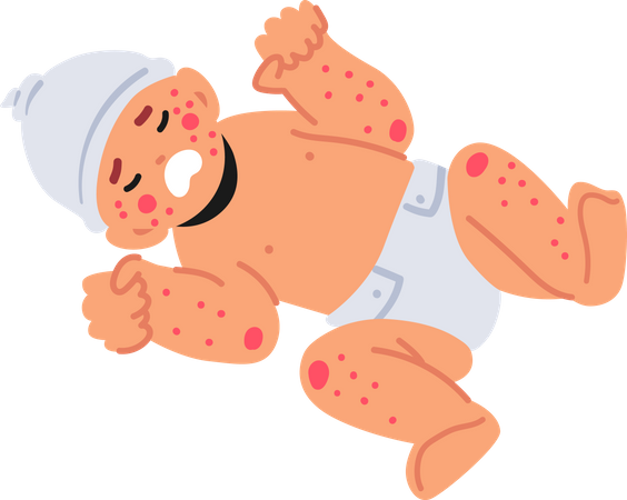 Newborn Child with Food Allergy Symptoms Illustration