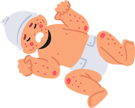 Newborn Child with Food Allergy Symptoms  Illustration