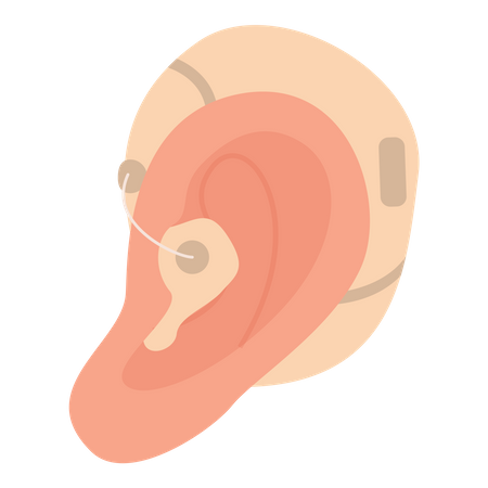 Ohr-Hörgerät  Illustration