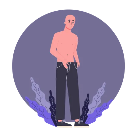 Efeitos Colaterais Da Quimioterapia Paciente Sofre De Doenca Oncologica Personagem Masculino Perdendo Peso Ilustracao Vetorial Em Estilo Cartoon Ilustração