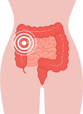 Pain in intestines Illustration