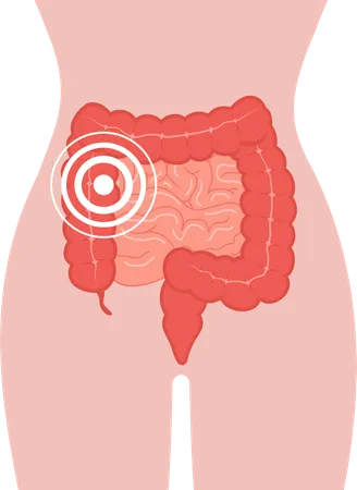 Pain in intestines Illustration