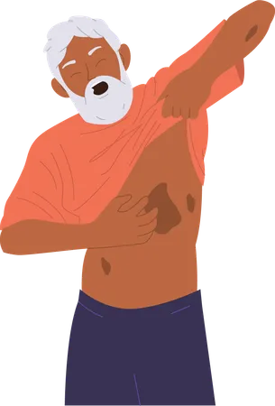 Patient âgé âgé souffrant de psoriasis  Illustration