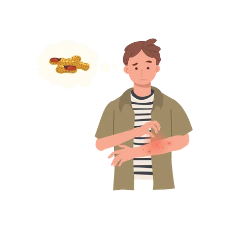 Peanut Allergy Reaction  from peanut  Illustration