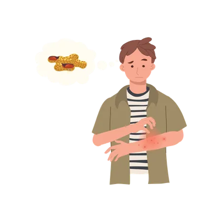 Peanut Allergy Reaction Man With Itchy Red Rash On Arm Allergic Skin Problem From Peanut Illustration
