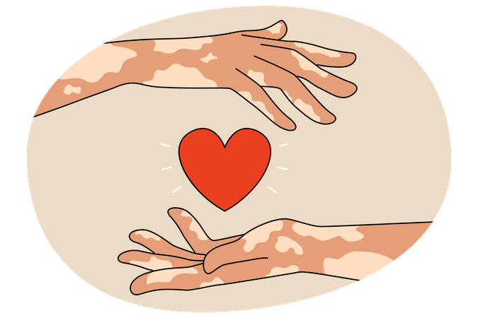 Person with leprosy hold heart  Illustration