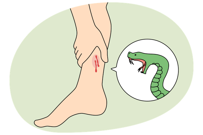 Mordedura de serpiente en la pierna de una persona  Ilustración