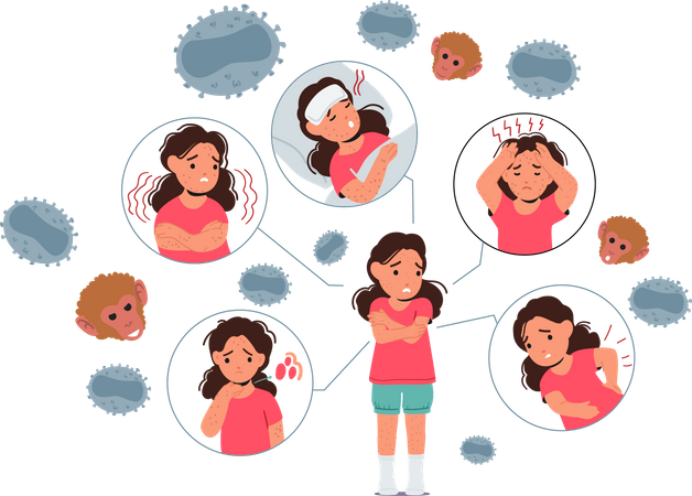 Petite fille présentant des symptômes du virus Monkeypox  Illustration