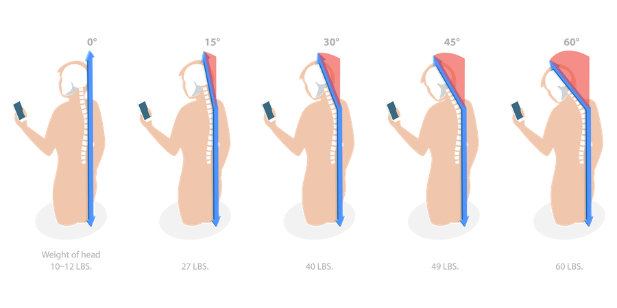 Phone Posture  Illustration